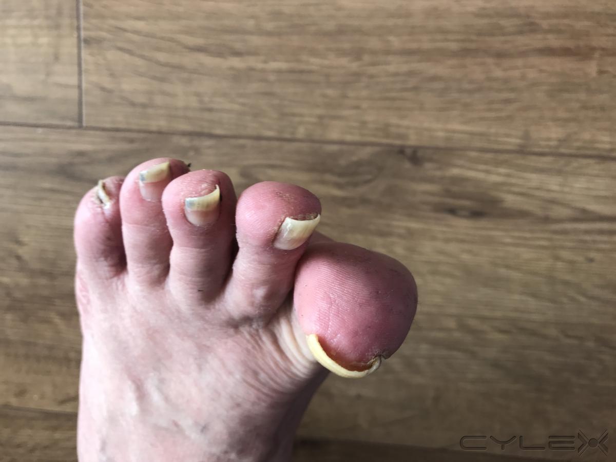 Feet first Mobile Foot Health Clinic®, Westonsupermare