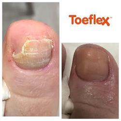 FEET Unlimited